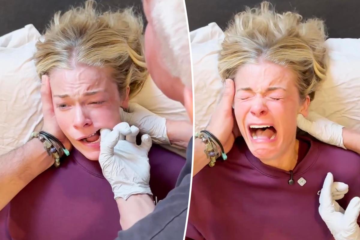 LeAnn Rimes cries as she undergoes brutal 'deep jaw surgery'